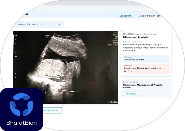 BharatBion — AI-assisted ultrasound analysis platform